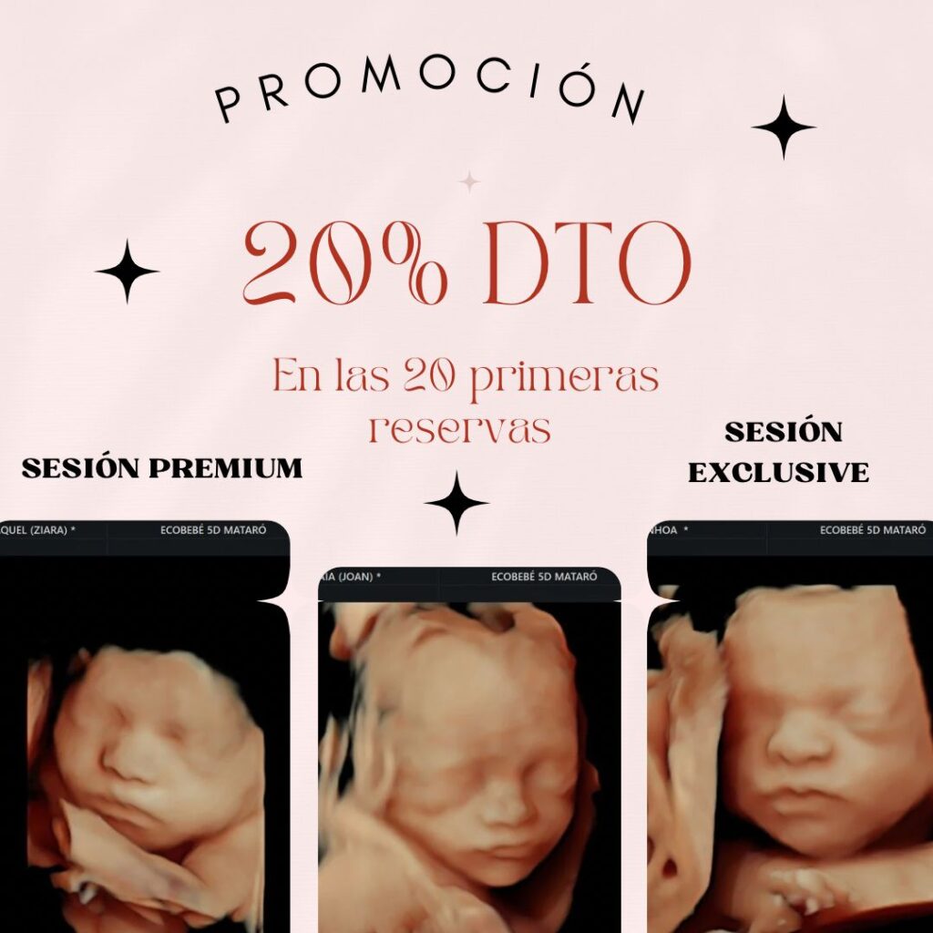 PROMOCIÓN ECOGRAFÍA 5D BARCELONA MATARÓ