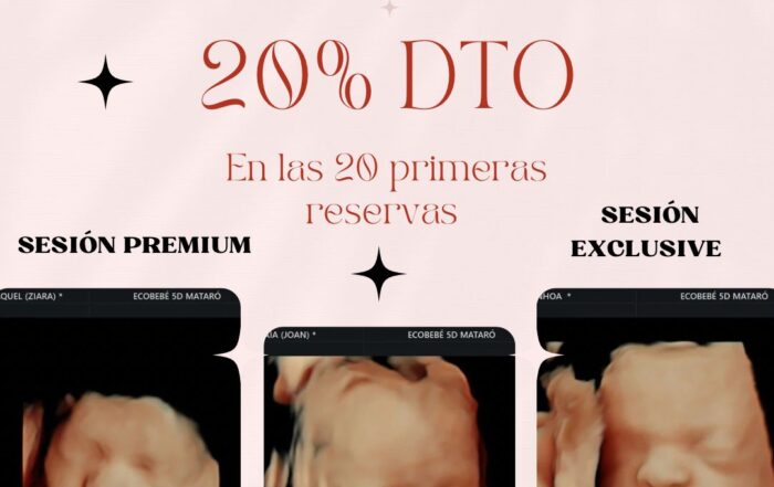PROMOCIÓN ECOGRAFÍA 5D BARCELONA MATARÓ