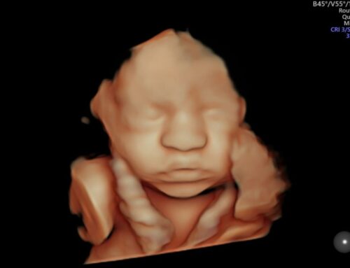 Diferencia ecografía 4D y 5D Mataró: ¿cuál elegir?