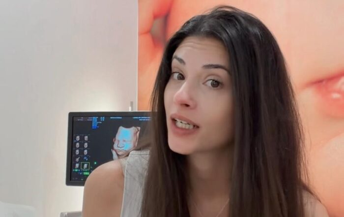 ¿Tu bebé no se deja ver? Descubre una ecografía 5D con paciencia